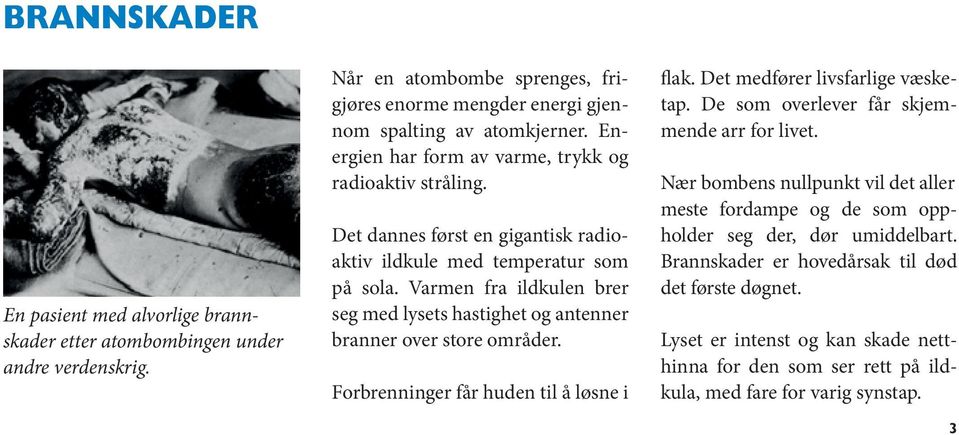 Varmen fra ildkulen brer seg med lysets hastighet og antenner branner over store områder. Forbrenninger får huden til å løsne i flak. Det medfører livsfarlige væsketap.