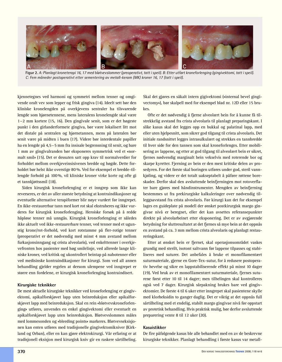 kjennetegnes ved harmoni og symmetri mellom tenner og omgivende oralt vev som lepper og frisk gingiva (14).