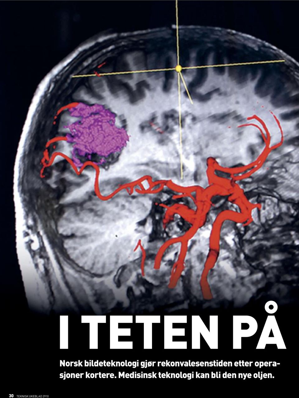 rekonvalesenstiden etter operasjoner