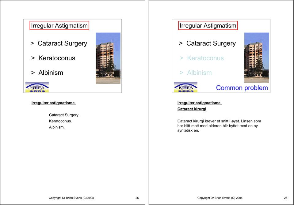 Cataract Surgery. Keratoconus. Albinism. Irregulær astigmatisme.