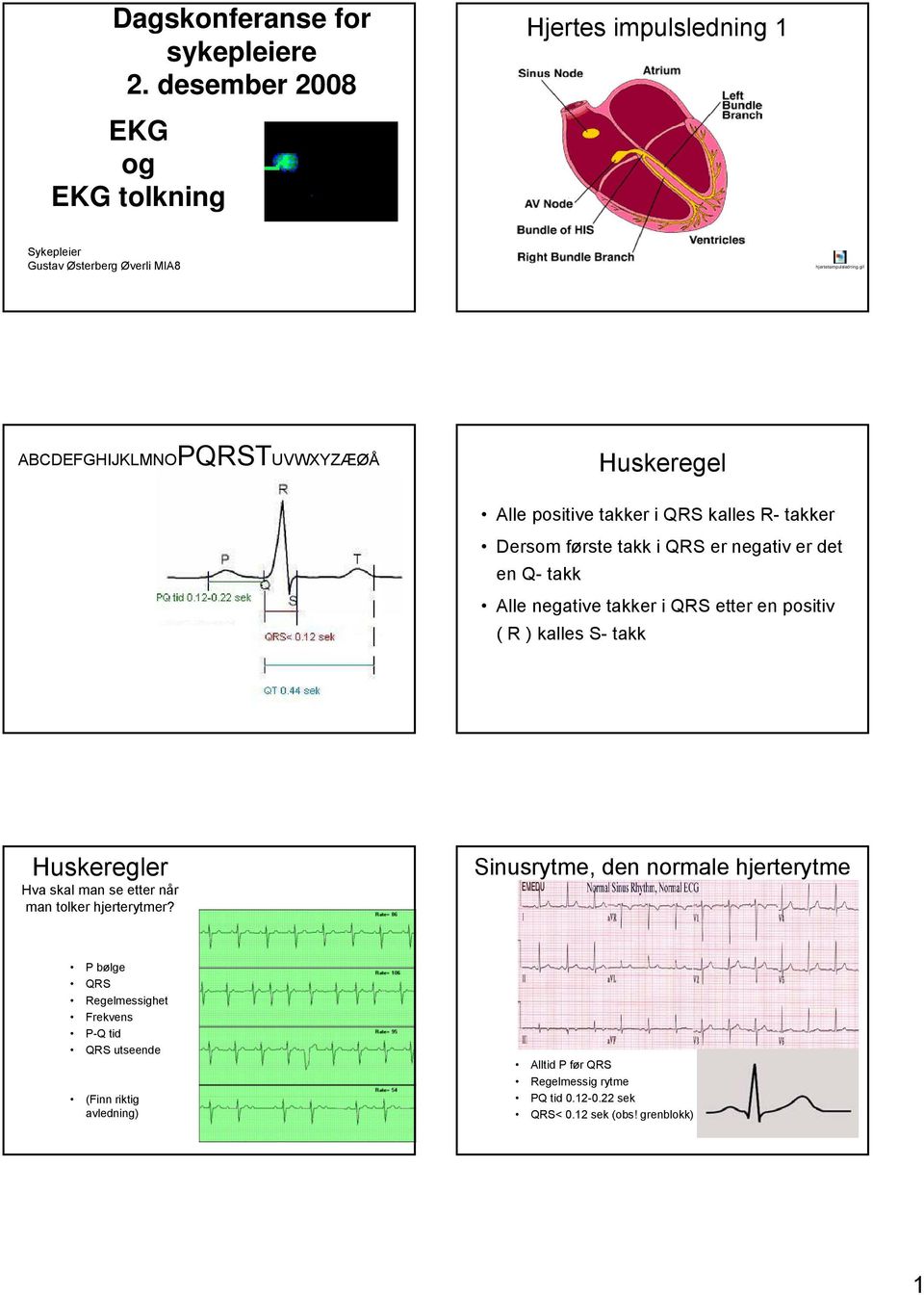 takker i QRS etter en positiv ( R ) kalles S- takk Huskeregler Hva skal man se etter når man tolker hjerterytmer?