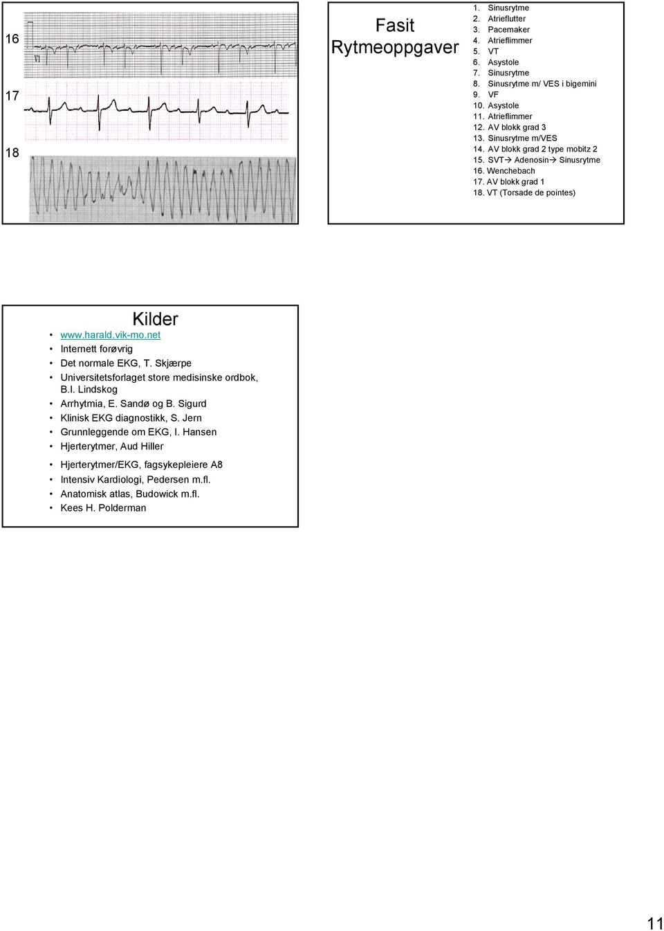 VT (Torsade de pointes) Kilder www.harald.vik-mo.net Internett forøvrig Det normale EKG, T. Skjærpe Universitetsforlaget store medisinske ordbok, B.I. Lindskog Arrhytmia, E. Sandø og B.