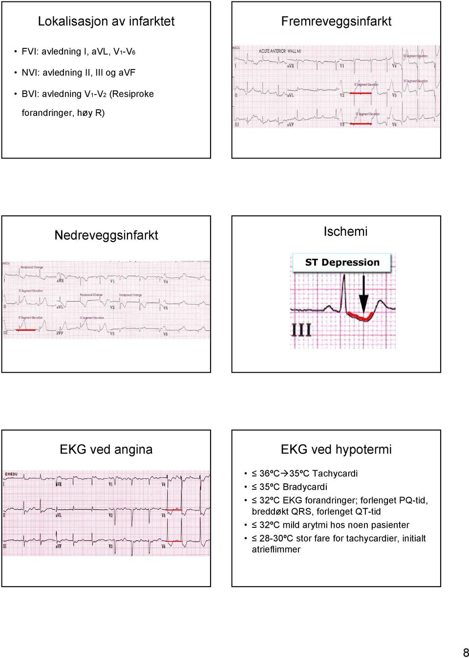 hypotermi 36ºC 35ºC Tachycardi 35ºC Bradycardi 32ºC EKG forandringer; forlenget PQ-tid, breddøkt QRS,