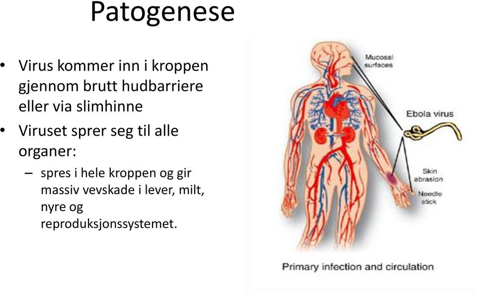 til alle organer: spres i hele kroppen og gir massiv