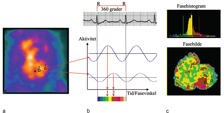 MEDISIN OG VITENSKAP Originalartikkel Figur 1 Illustrasjon av Fourier-transformasjon. a) Rådata fra 99m Tc-merkede erytrocytter hvor bildet viser hjertets aktivitetsoppladning i endediastolen.