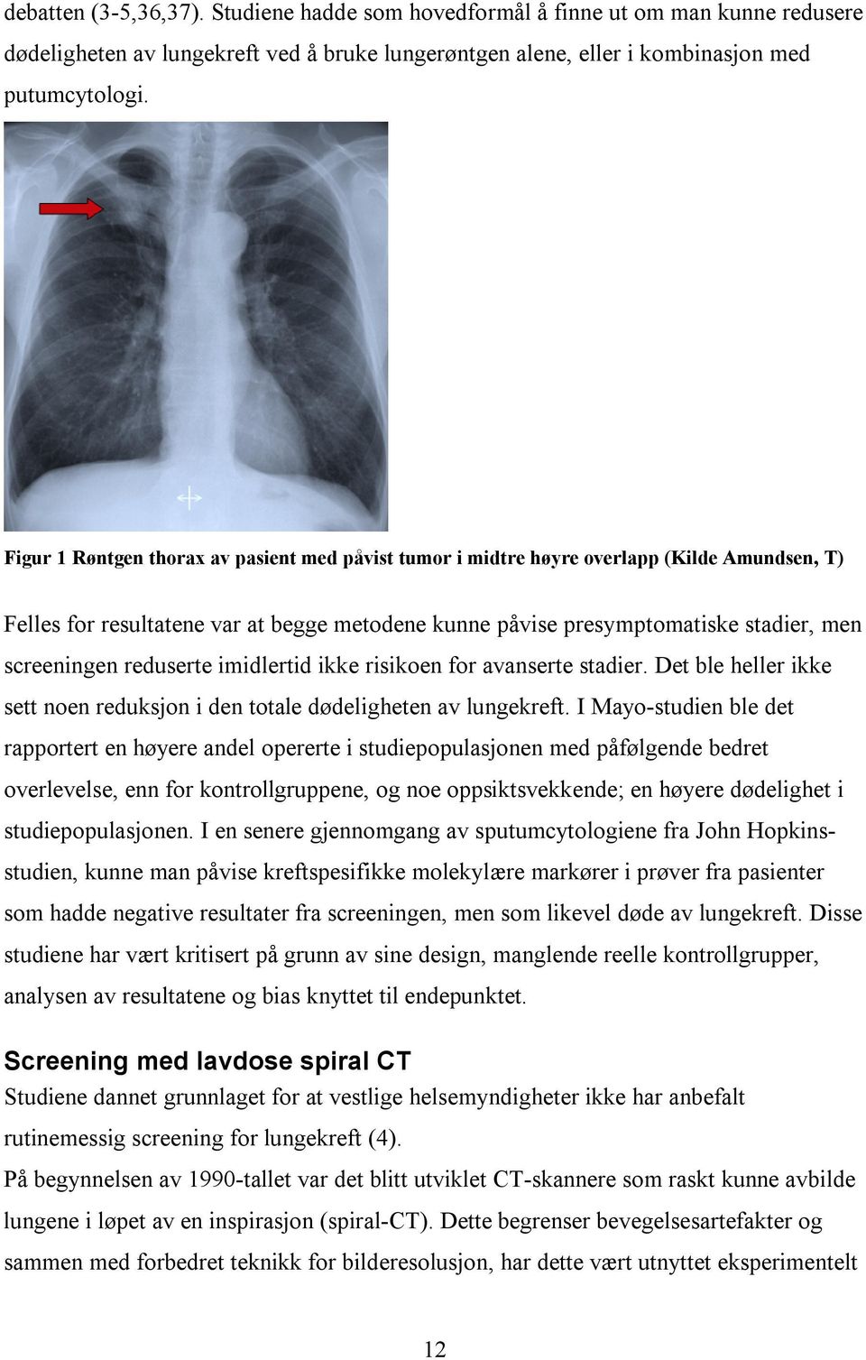 reduserte imidlertid ikke risikoen for avanserte stadier. Det ble heller ikke sett noen reduksjon i den totale dødeligheten av lungekreft.