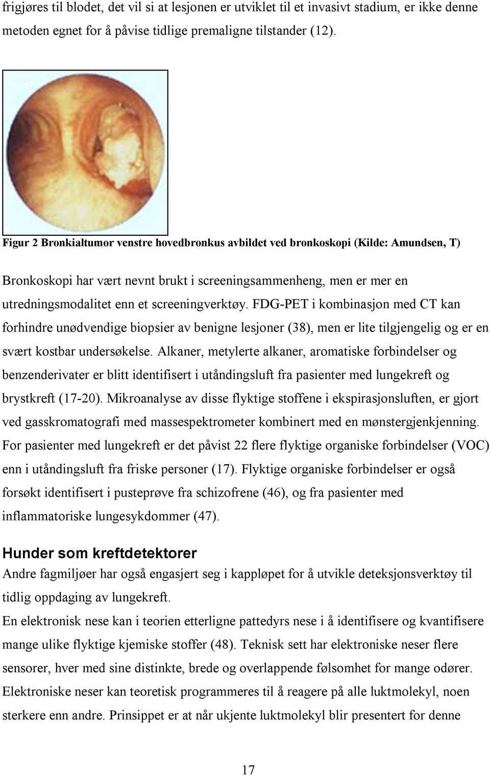 screeningverktøy. FDG-PET i kombinasjon med CT kan forhindre unødvendige biopsier av benigne lesjoner (38), men er lite tilgjengelig og er en svært kostbar undersøkelse.