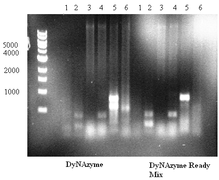 4.2 PCR av mdkk3 og hdkk3 promoter For å kunne klone DKK3 promoteren fra mus og menneske i pcr2.1-topo vektor blir det først utført PCR reaksjon.