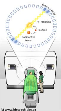 Grunnkurs i radiologi: Gruppeundervisning Positronemisjonstomografi (PET) Nukleærmedisinsk diagnostikk med positronstråler Martin Biermann Førstemamanuensis 512 kev 512 kev Kst.