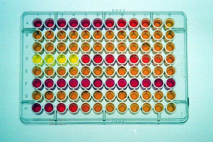 Eceda: In vitro biotester In vitro cell bioassays: sensitive, specific, and rapid bio-analytical tools that are useful in characterising responses in complex environmental mixtures.