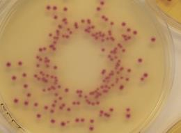 Resultater ulike genotyper BD/BBL CHROMagar MRSAII: Detekterte ikke 2,9% av genotypen (nr = 6) Oxoid/Brilliance MRSA: Detekterte ikke 2,9% av genotypene (nr = 6) BioMérieux/chromID MRSA: Detekterte