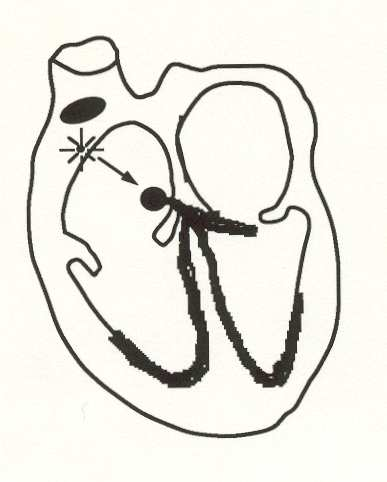 Atrial