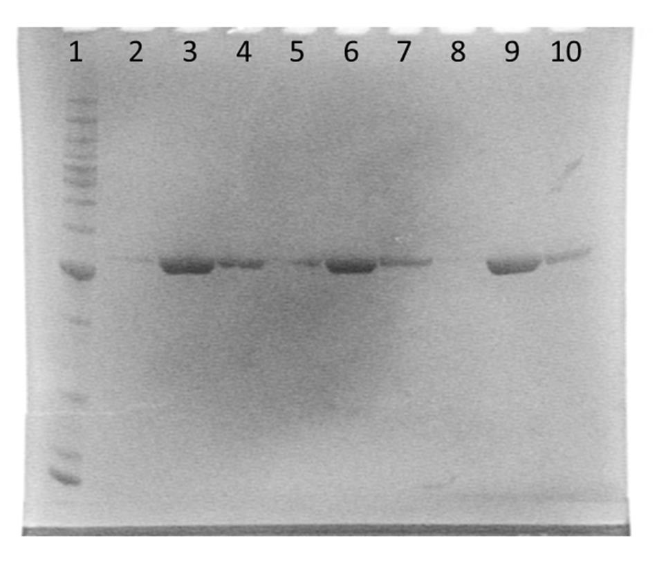 4. Resultater Figur 29: SDS-page gel av ChiB Y145F etter rensing på kitinkolonne. Brønn 1 inneholder ladder, brønn 2 er periplasmatisk ekstrakt.