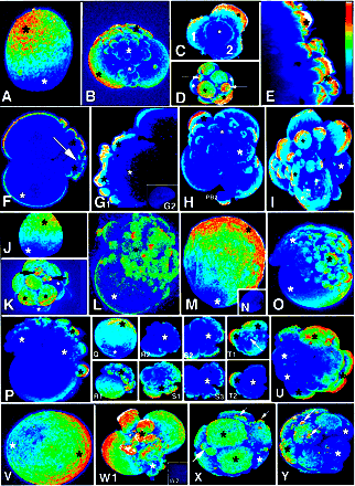 Human embryos Antezac &Van Blerkom Human Reprod 14, 429, 1999 Leptin ekspresjon ( A-L): (trofoblast funksjon aktiverer STAT 3 ) STAT3 ekspresjon (J-L) :