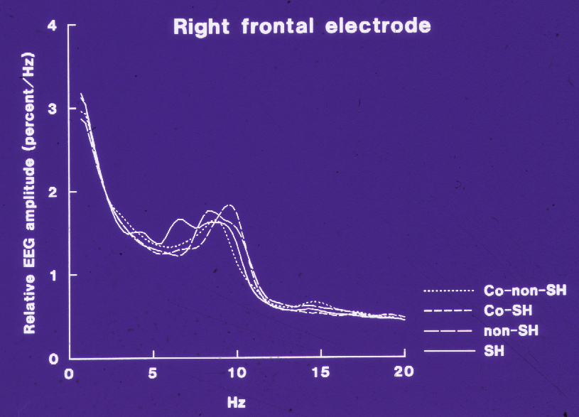 Kvantitativt EEG (QEEG) og andre avanserte metoder Magnetencefalografi (MEG) EEG og MEG integrert med MRI Kvantitativ frekvens-analyse (FFT) av EEG (eks: