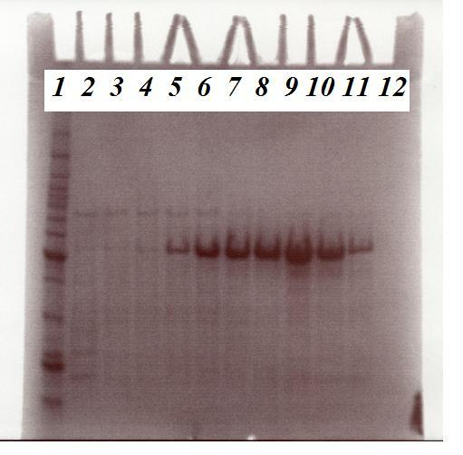 Appendix c) d) Figur 7.1: a) Kromatogram for rensing av ChiB-F190A ved hjelp av ionebytterkromatografi. Proteinet ble eluert ut i den siste toppen.