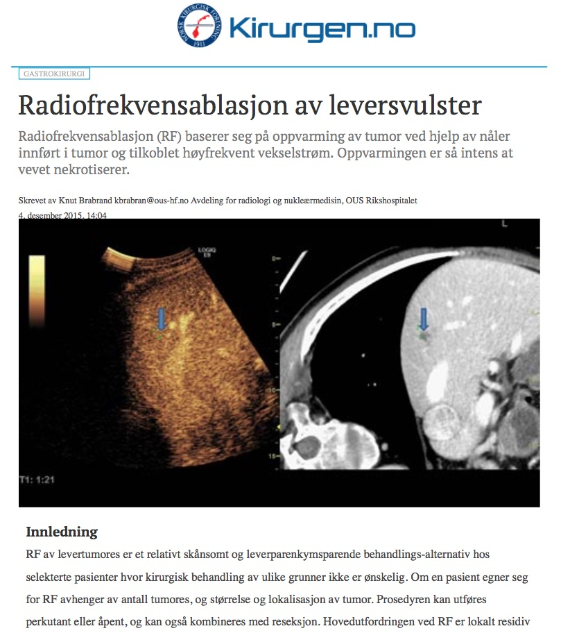 Ultralydveiledet Radiofrekvensablasjon av leversvulster