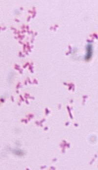 Haemophilus influenzae Normalflora i øvre luftvegar Hib: 2-5 % før vaksineintroduksjon Akapsulære (ikkje-typbare): svært hyppig Kapsulære polysakkaridkapsel Type a, b,