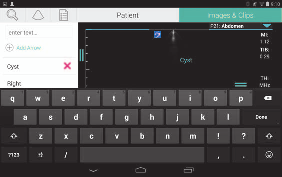 Legge inn tekst Når du fyller ut skjemaer i SonoSite iviz, for eksempel når du oppdaterer pasientjournaler eller konfigurerer innstillinger, kan du angi tekst ved å trykke på tekstfeltet du vil