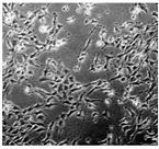 2 MATERIALE OG METODE 2.2.2 4T1 celler Denne studien ble påbegynt med 4T1 celler (ATCC CRL-2539, USA) fordi denne tumor cellen har flere egenskaper som gjør den godt egnet til forskningsarbeid.