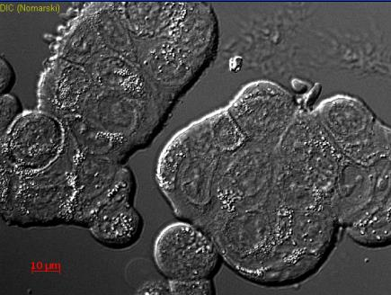 2 MATERIALE OG METODE Disse celle ble tatt opp fra flytende nitrogen, der de var frosset ned med 95 % komplett vekstmedie og 5 % DMSO. Opptinningen ble gjort som beskrevet i 2.2.1.