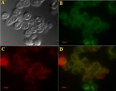 3 RESULTATER a) b) c) Figur 45: Fasekontrast- og fluorescensbilder av AlPcS 2a og C11-PEG gull nanopartikler i HT29 celler og autofluorescens av HT29 celler.