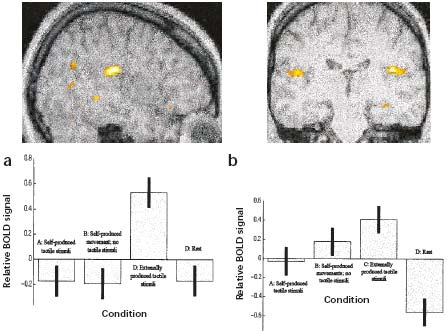 Frith proposes that if prediction is faulty, subtraction will be less effective, and the sensory consequences of self generated movements will be more like the sensory consequences of externally