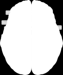 Svelgeprosessen En kompleks og dynamisk nevromuskulær aktivitet. Motorisk Sensorisk Trigeminus (V). Facialis (VII).