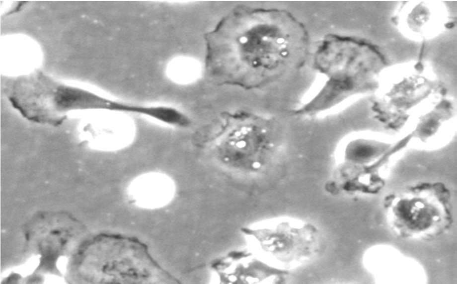 Resultater Ustimulerte mononukleære leukocytter CpG-B (2uM) 5-7 dager Poly (I:C) (20 μg/ml) 5-7 dager Figur 11: adherente mononukleære celler differensierer til celler med DC karakteristika etter