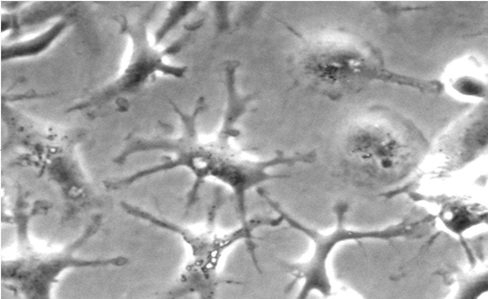 Figur 12 og 13 viser at individ 1 generelt utviste større respons på stimuleringen, mens individ 2 viste en lavere respons.