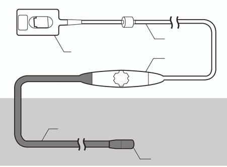 Kobling Kabel Kontroller 90 cm Må ikke nedsenkes Kan nedsenkes Endoskopsk aft Skannehode Figur 5-2 TEExi-komponenter Du må ta vare på resultatene av strømlekkasje- og bitehulltester for hver