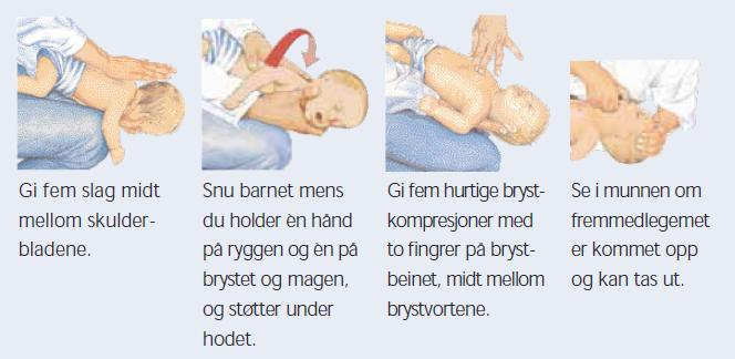 Plasser en knyttneve med tommelfingeren midt mellom navlen og brystbeinspissen. Legg den andre hånden utenpå den første.