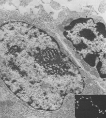 Inneholder en basisk N- terminal region som interagerer med DNA. Gcn4 Max like transkripsjonsfaktorer kan danne kompleks Flere klasser av transkripsjonsfaktorer kan danne heterodimerer.