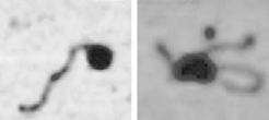 DNA helix H1 Lysinrike N- terminale sekvenser I noen tilfeller kan flere transkripsjonsaktivatorer som binder til ulike regulatorsekvenser inne i nukleosomene være nok til at nukleosomstrukturen