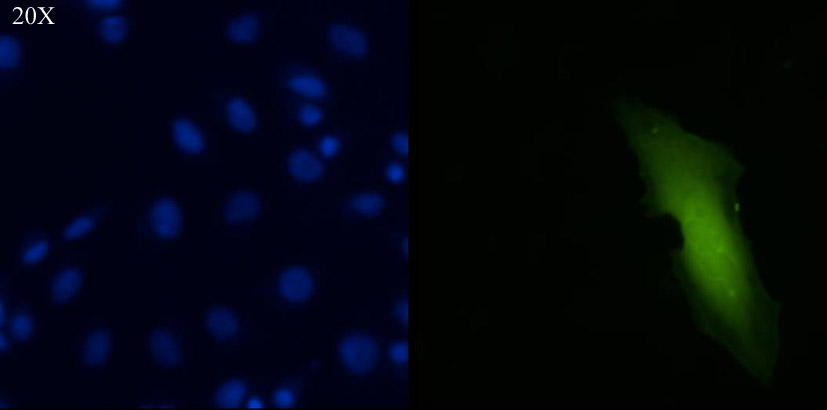 Resultater Figur 4.16 ASK-celler transfektert med pmaxgfp og tilsatt 100 µm rosiglitazon. 4.3.