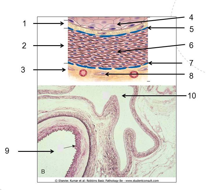Oppgave 4 (10 poeng) a. Den øverste delen av figuren viser et snitt gjennom en arterie, der tallene 1 til 8 markerer ulike strukturer og celler. Hva er navnene på strukturene merket 1, 2, 3, 5 og 7?