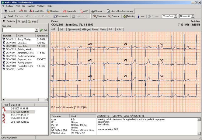1 Vise og endre EKG-informasjon Informasjonsvinduet gir deg all informasjon om EKG-målingen du ser på i øyeblikket.