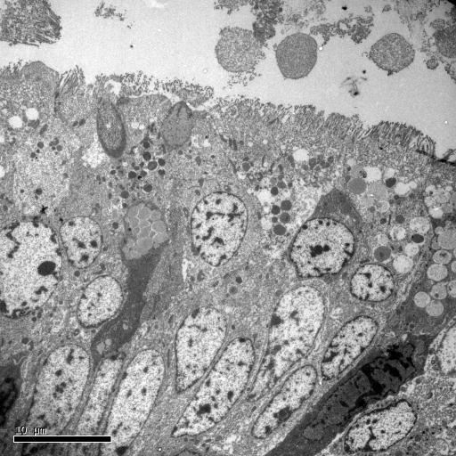 Resultater - Histologi