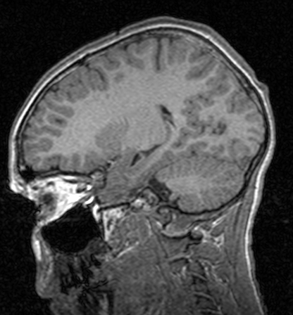 Ikke alle nuklider (atomkjerner) har spinnegenskaper Nuklider uten spinn gir intet NR signal 7 8 Noen nuklider med nettospinn Hdrogen er den ideelle NR-kjernen!