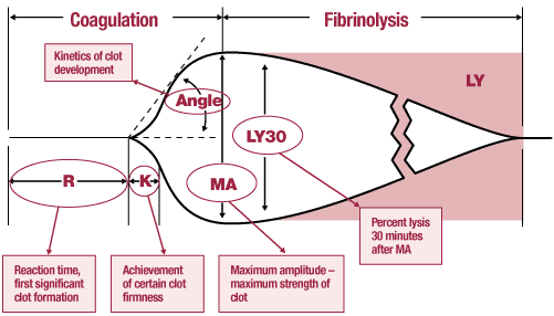 TEG (Thromboelastography) [21] Tromboelastografi (TEG) tester både blodplatefunksjon og koagulasjon ved å utføre assay på flere parametere ved koageldannelse dynamisk i fullblod.