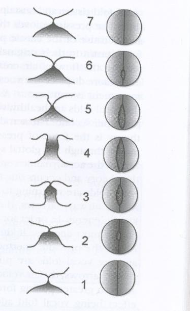 (Sapienza & Ruddy, 2009, s. 75) Figur 4 En glottisbølge på stemmebåndene, fra siden og ovenfra (Sapienza & Ruddy, 2009, s.