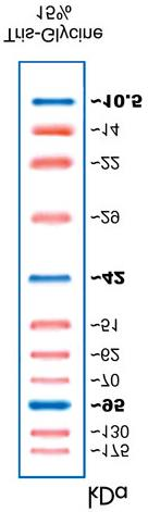 at proteina hadde blitt overført frå gel til membran. Figur 7: gel (t.v.) og membran (midt) etter endt blotting.