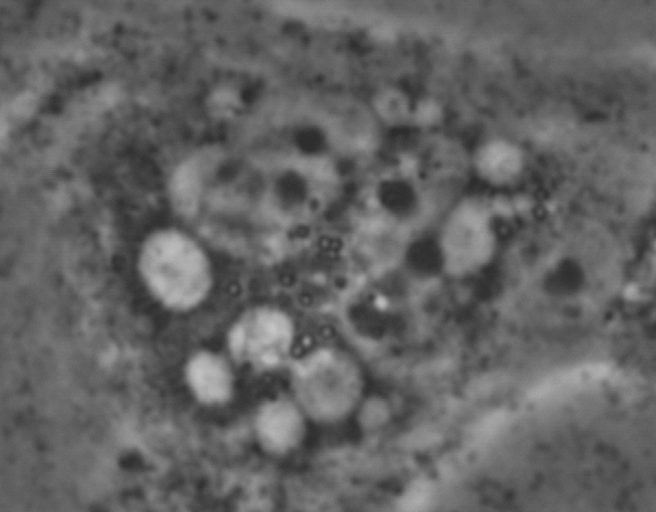 Figur 17A: Bildet er tatt gjennom et mikroskop på 40x forstørrelse