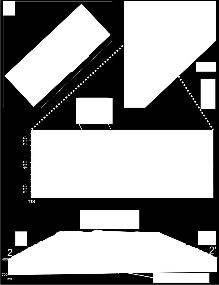 I tillegg observeres det også en brå fase-reversering langs refleksjonen (Fig.3.5.2B), og akustisk maskering av refleksjonene som ligger under disse høy-amplitude segmentene (Fig. 3.5.2C). Figur 3.5.2A: Skygge-relieffkart drapert med minimum amplitude-kart.