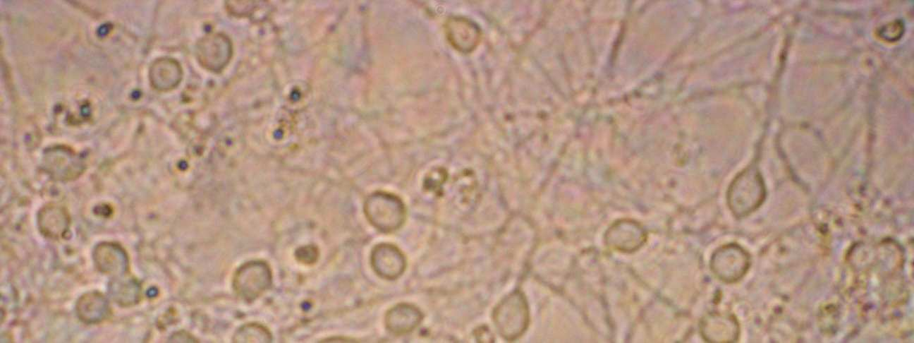 Metoder og materiale var klart atskilt. Supernatanten ble til slutt fjernet helt, og pelletten ble tilsatt 3 ml Løsning 3. Suspensjonen ble sugd opp og ned i pasteurpipetter med stadig tynnere spiss.