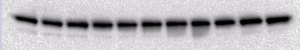 Resultater A C caspase-3 aktivitet (df/s)/ g totalprotein 15 HEK293 M38L M4C 10 5 caspase-3 aktivitet (df/s)/ g totalprotein 200 150 100 50 HEK293 M38L M4C 0 0 1 2 4 6 24 0 0 1 2 4 6 B Tid (timer)