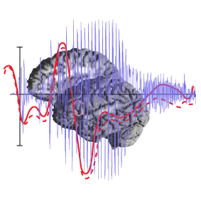 Måling av aktivitet i hjernen Moderne teknologi (MRI, CT, ERP) kan gi et enda mer nøyaktig bilde Forandringer i hjerneaktivitet 9 Neurolingvistiske data: Neurolingvistiske data: hvor språket sitter