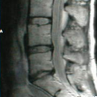 Diagnostiske utfordringer (forts)