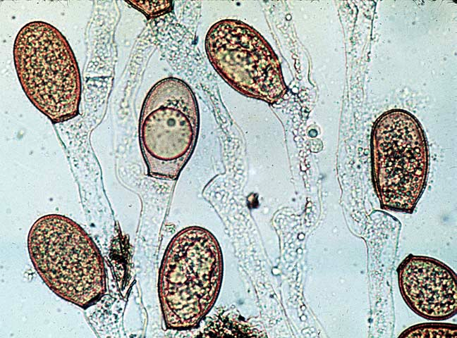 Fra mycelet dannes morfologiske strukturer som tjener til soppens overlevelse og spredning, ofte både for seksuell og aseksuell formering.