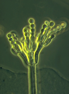 Er ascosporene du ser dannet ved seksuell eller aseksuell reproduksjon? Hva er årsaken til at man finner det observerte antall sporer i ascus? Har hyfene hos sekksporesopp skillevegger (septa)?